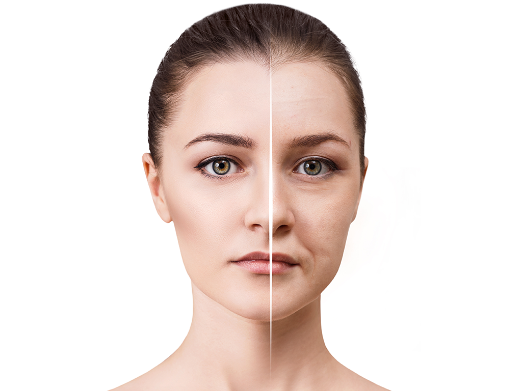 Skin Peel Treatments from Renew Clinic in Nantwich, Cheshire Skin Peel Treatments from Renew Clinic in Nantwich, Cheshire