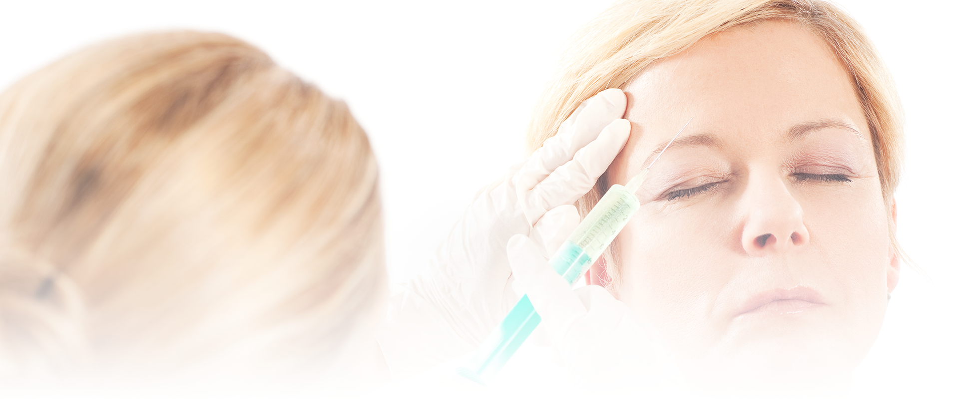 Dermal Fillers from the Renew Clinic in Nantwich, Cheshire